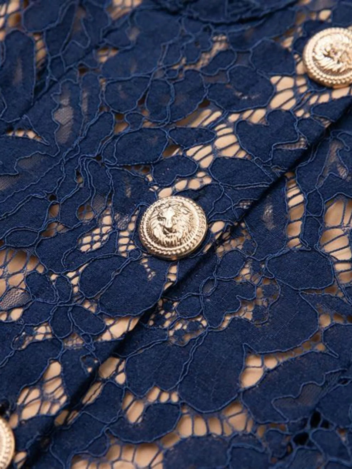 Lace Button-Down Midi Dress