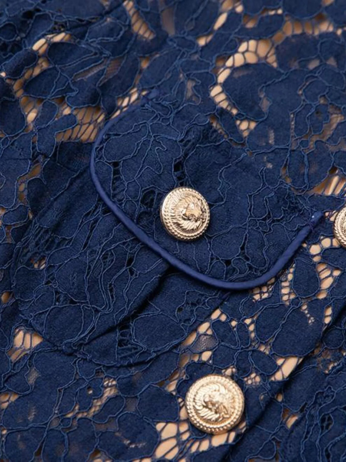 Lace Button-Down Midi Dress